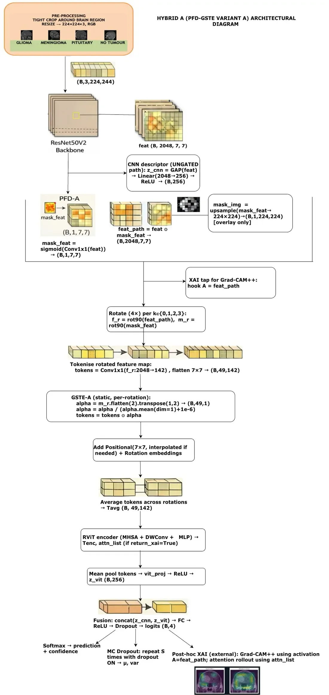 Hybrid A architecture showing ResNet50V2, PFD guidance, 49 CNN feature tokens, RViT processing, and late fusion.