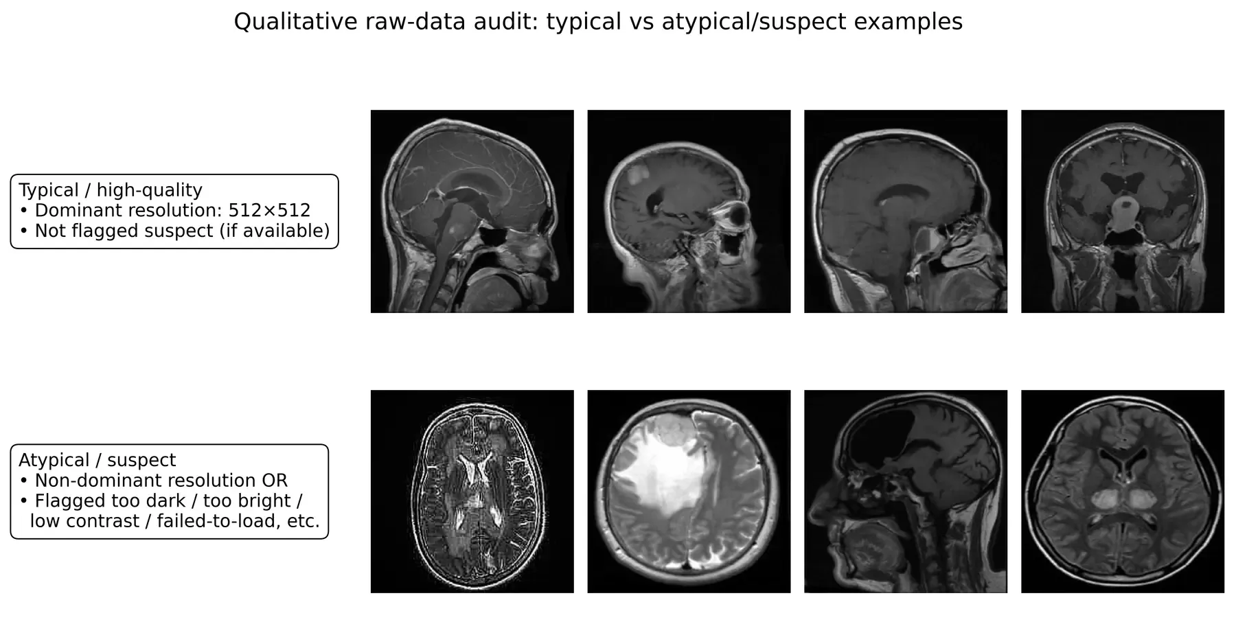 Representative brain MRI images inspected during the rule-based raw-image audit.