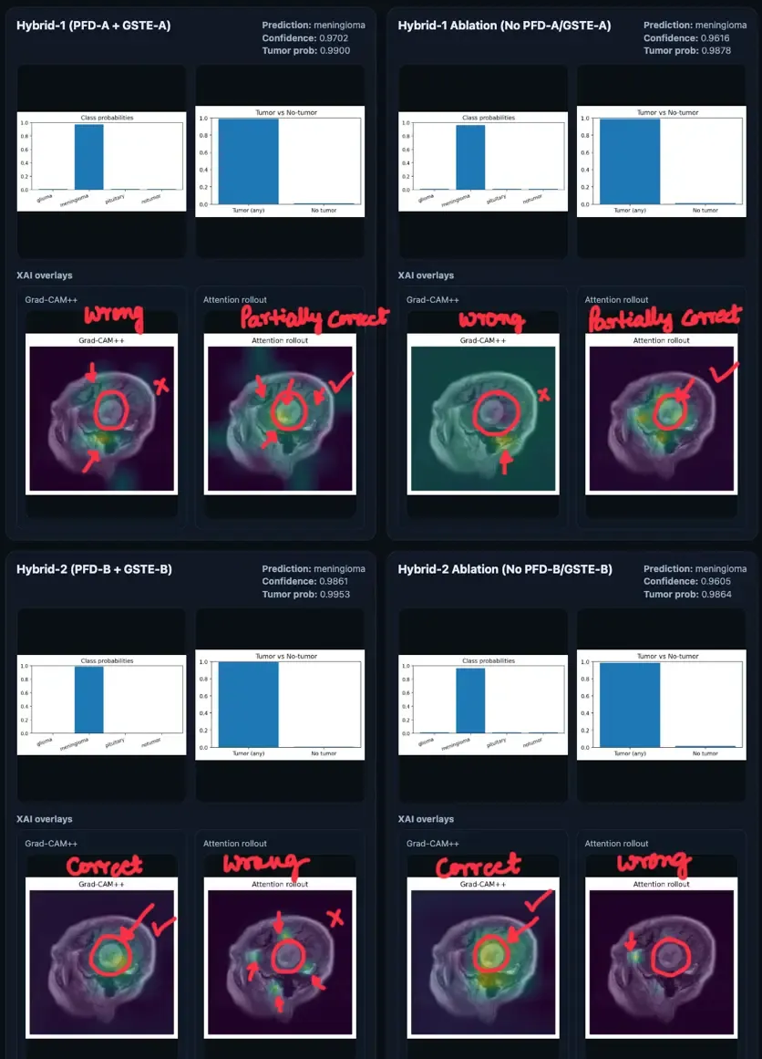 Grad-CAM++ and Attention Rollout comparison for a correctly classified meningioma across all four model variants.